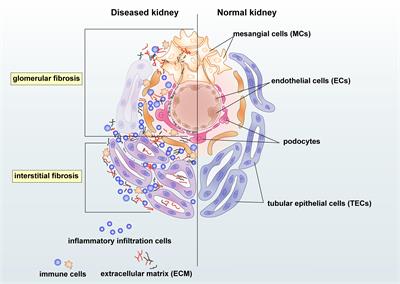 Transforming Growth Factor-β and Long Non-coding RNA in Renal Inflammation and Fibrosis